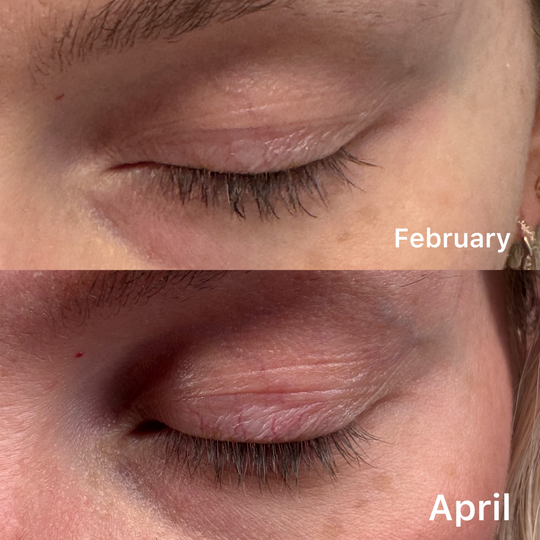 Lash & Brow Growth Serum – AW Lashes